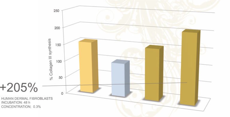 Results