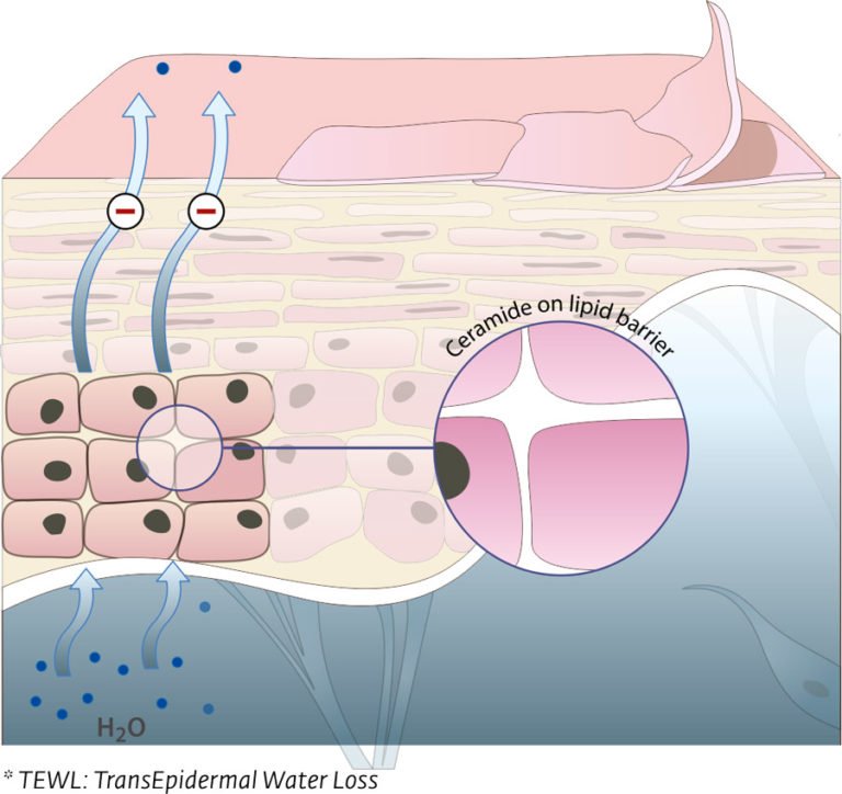tewl-ceramide